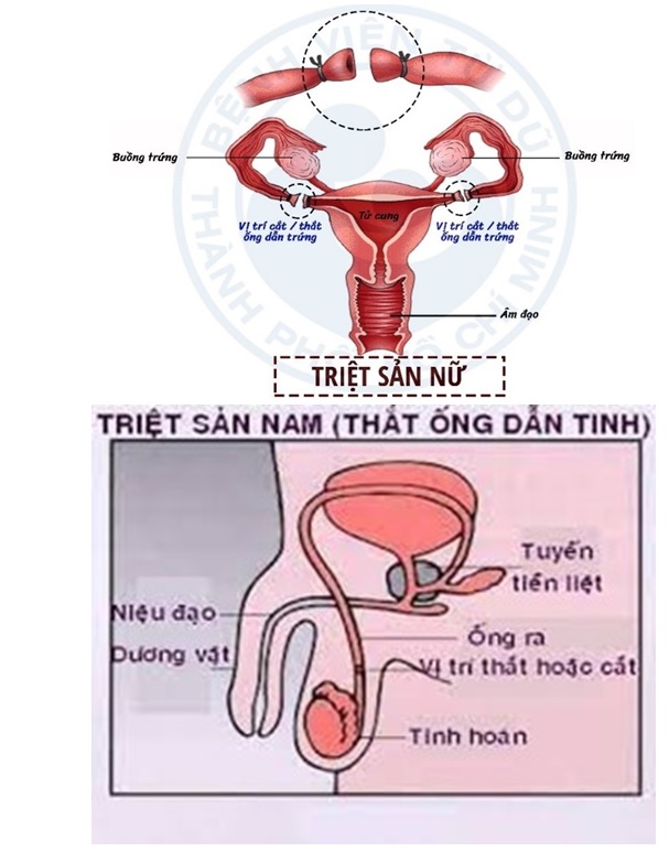 HƯỞNG ỨNG NGÀY TRÁNH THAI THẾ GIỚI 26/9/2023